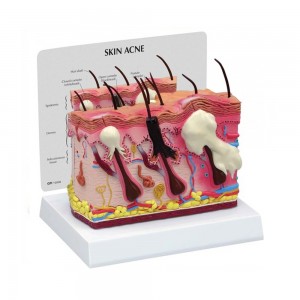 [과학쌤이오] 인체 내부 피부 모형 정상 여드름 G3751