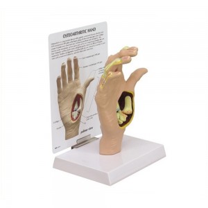 [과학쌤이오] 인체 골격 교육 손 골관절염 모형 G193