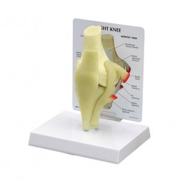[과학쌤이오] 인체 골격 근육 무릎 관절 모형 G100