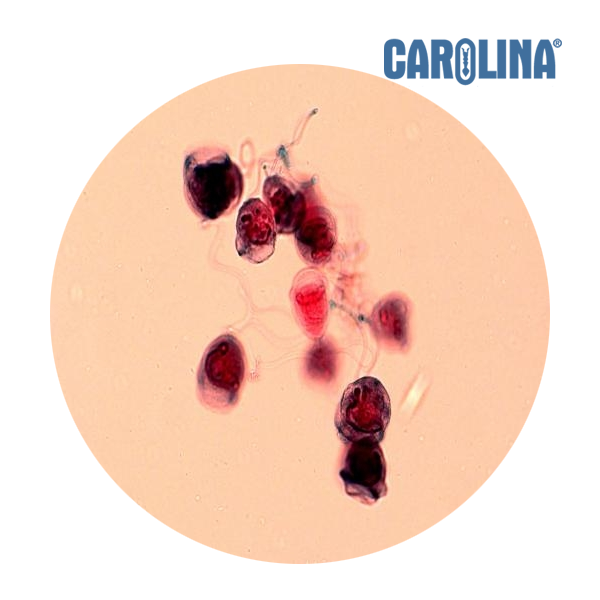 [과학쌤이오] 생명과학 종벌레 Vorticella 슬라이드