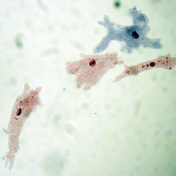 [과학쌤이오] 아메바 염색 고정 슬라이드표본